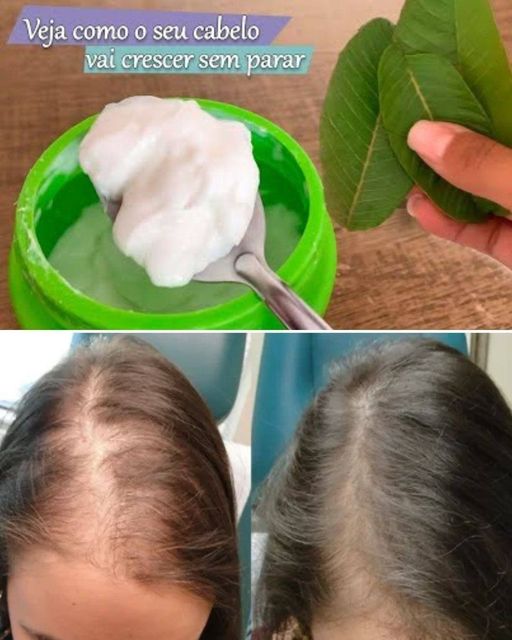 Como Usar Folhas de Goiaba para Parar a Queda de Cabelo: Receita Natural e Eficaz